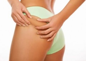 Cellulite: l' esame per valutarla e omeopatia iniettabile